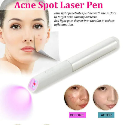 Red Blue Light Therapy Pen
